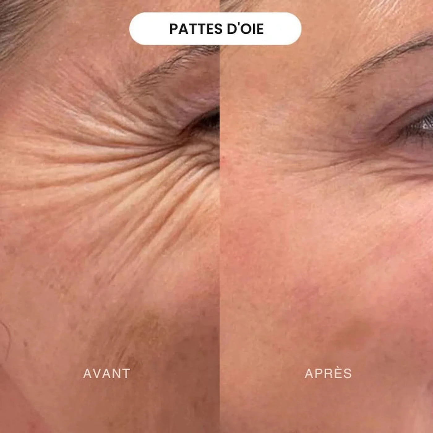 Crème de jour anti-âge 15ml