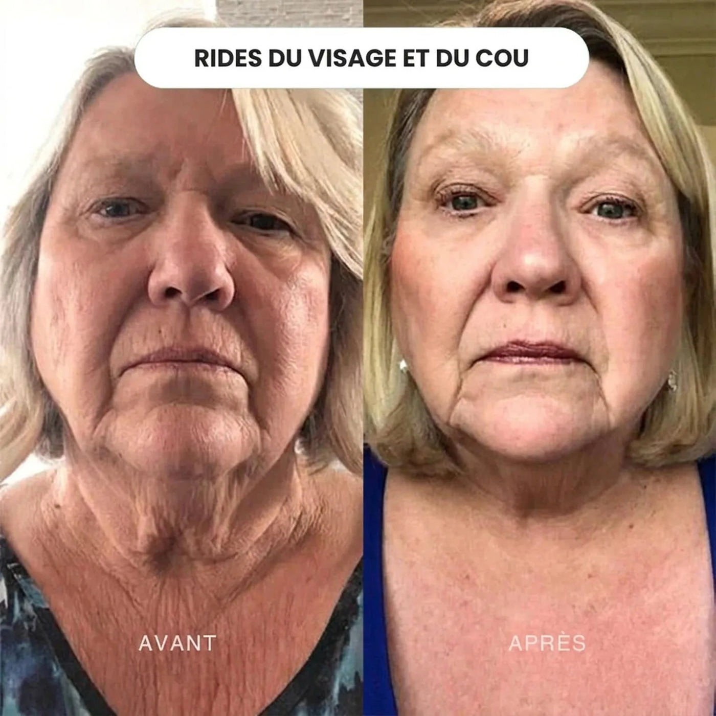 Crème de jour anti-âge 15ml