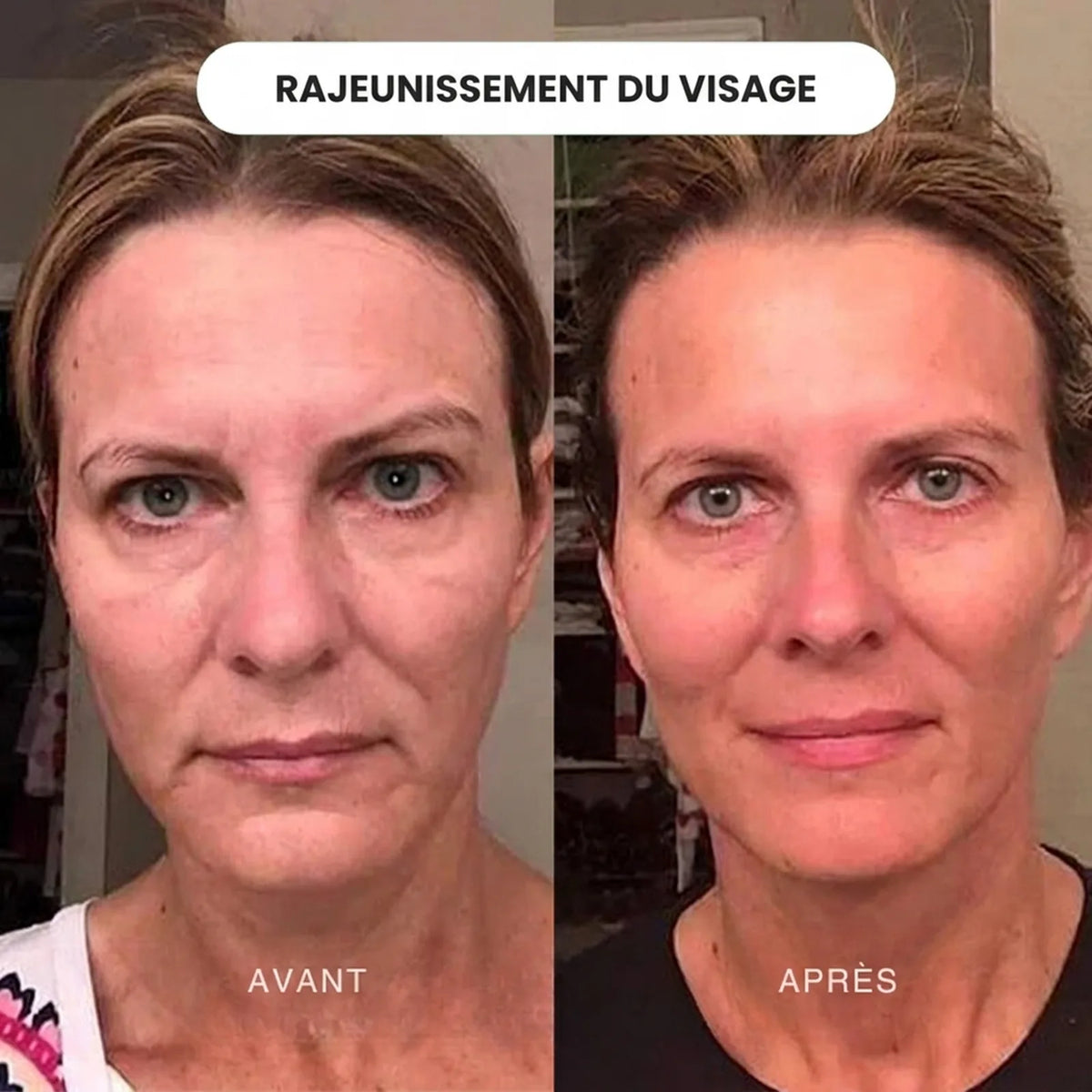 Crème de jour anti-âge 15ml