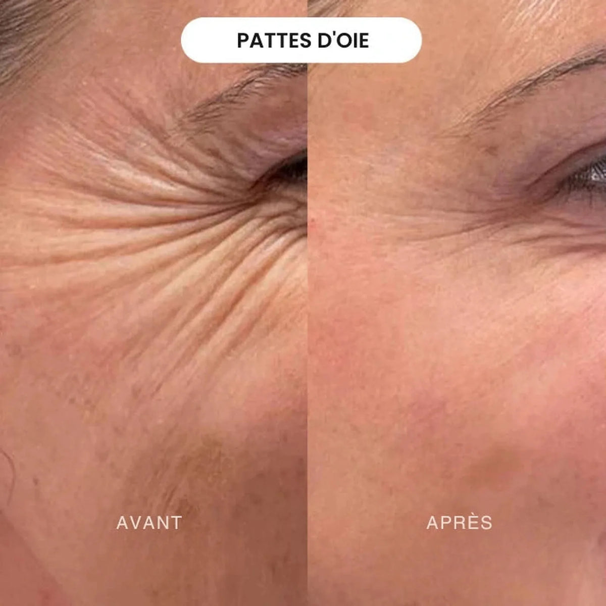 Crème de jour anti-âge 15ml